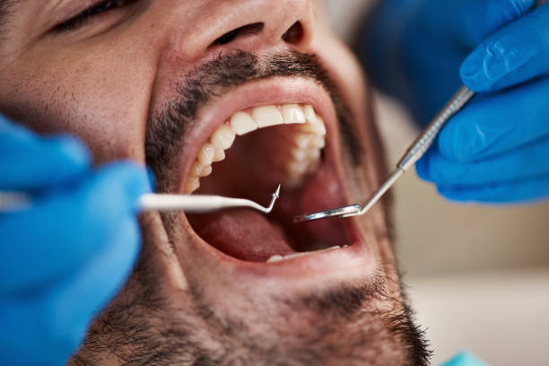 Best 24-Hour Emergency Dentist in White Hall, IL