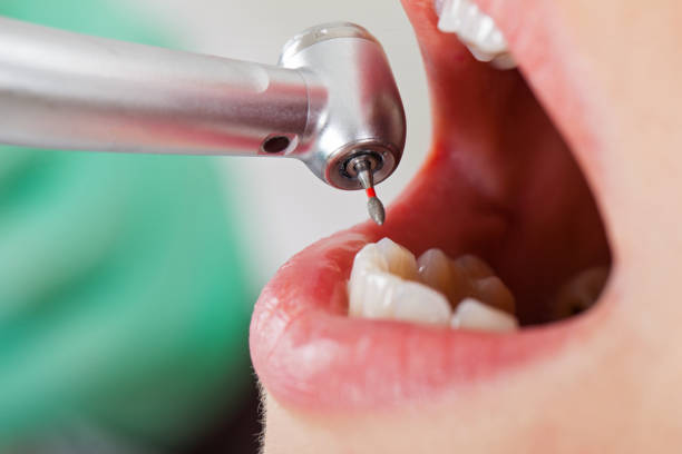 Best Emergency Denture Repair in White Hall, IL